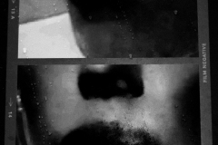 lips-before-after-BnW